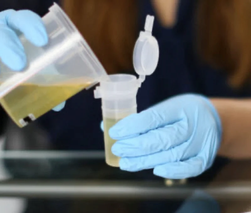 careful urine testing