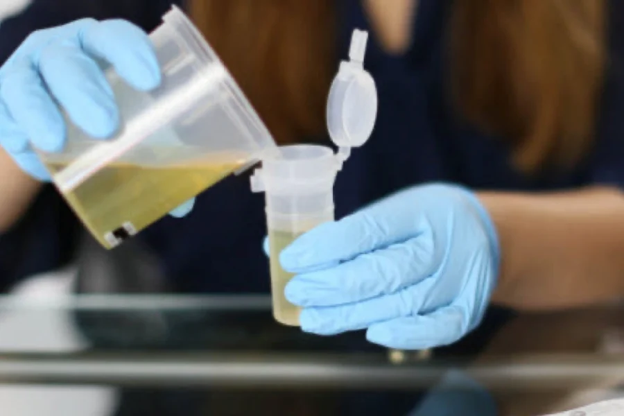 careful urine testing