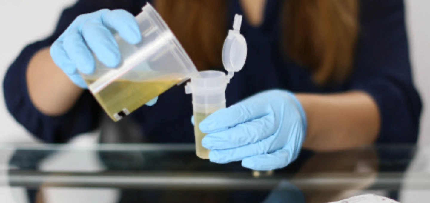 careful urine testing